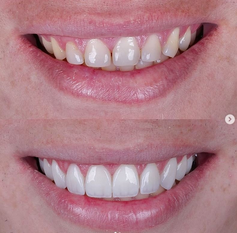 Armineh Dental Görsel 2